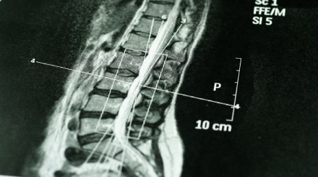 Chiropractic-East-Providence-RI-X-Rays.jpg